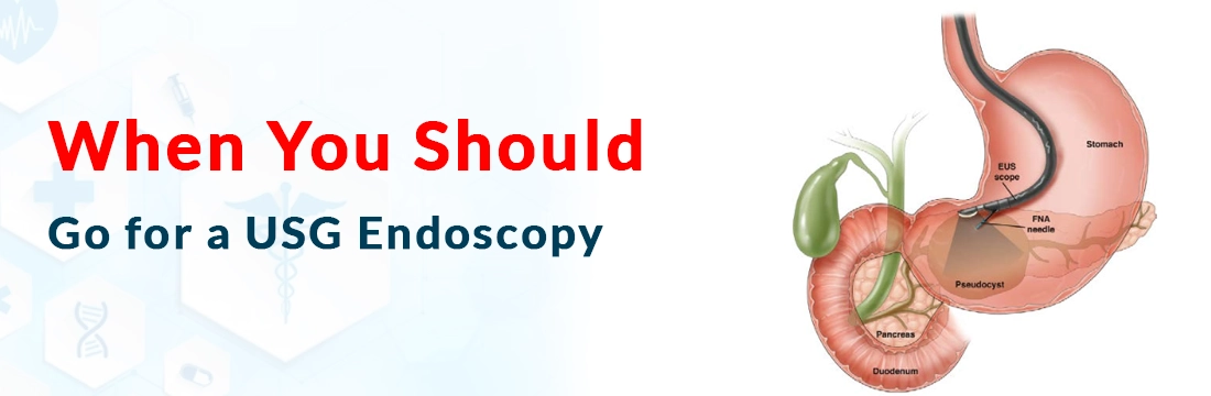 When You Should Go for a USG Endoscopy